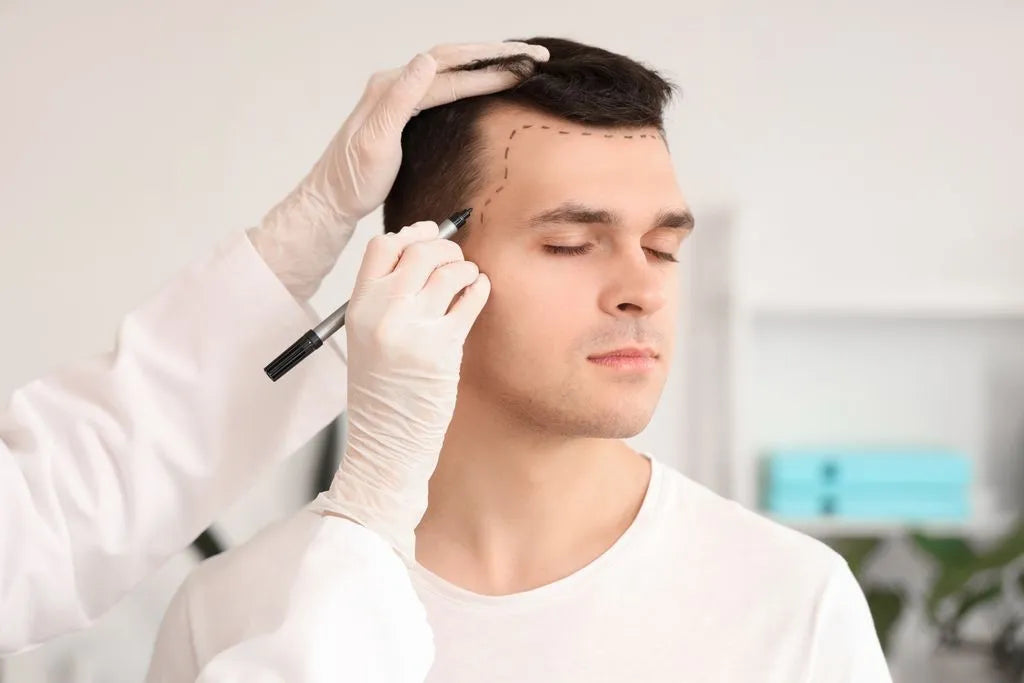 Hair Transplant - DHI Technique